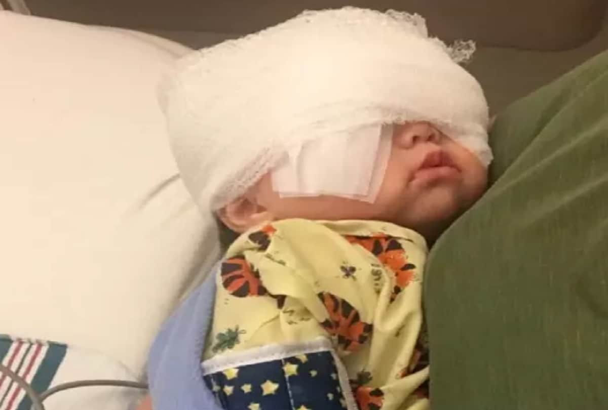 Little Girl Mehlani Big and Beautiful Eyes Are Due To A Rare Genetic Axenfeld Rieger syndrome