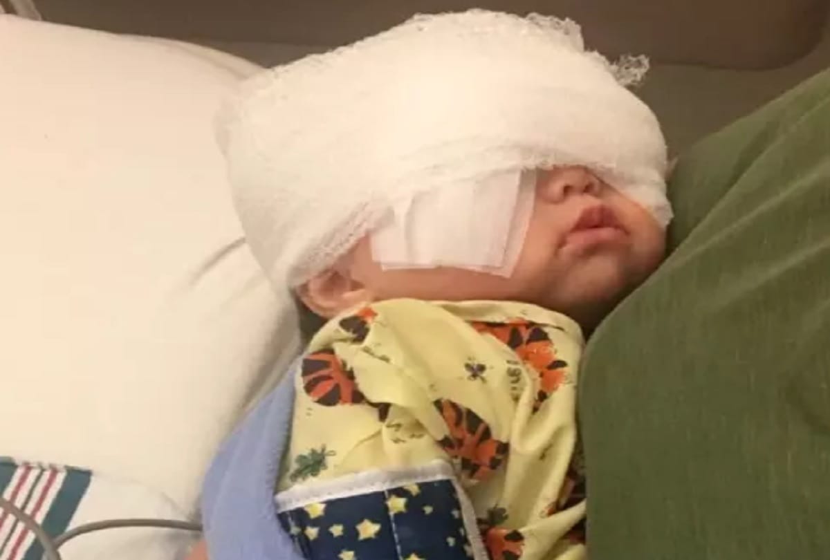 Little Girl Mehlani Big and Beautiful Eyes Are Due To A Rare Genetic Axenfeld Rieger syndrome