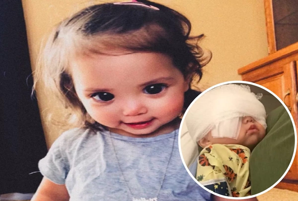Little Girl Mehlani Big and Beautiful Eyes Are Due To A Rare Genetic Axenfeld Rieger syndrome