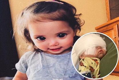 This Little Girl's Big, Beautiful Eyes Are Due To A Rare Genetic