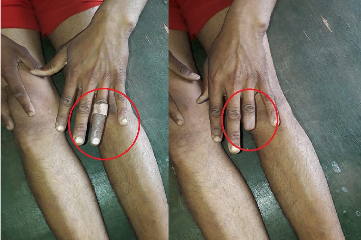 Meerut, An accused was caught with fake finger in the UP police recruitment test