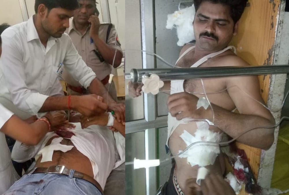 Goons shoot two brothers in sultanpur.