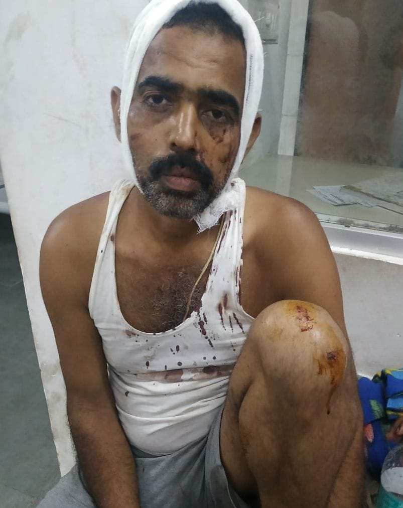 डंठल काटने से रोका तो प्रधान ने की पिटाई