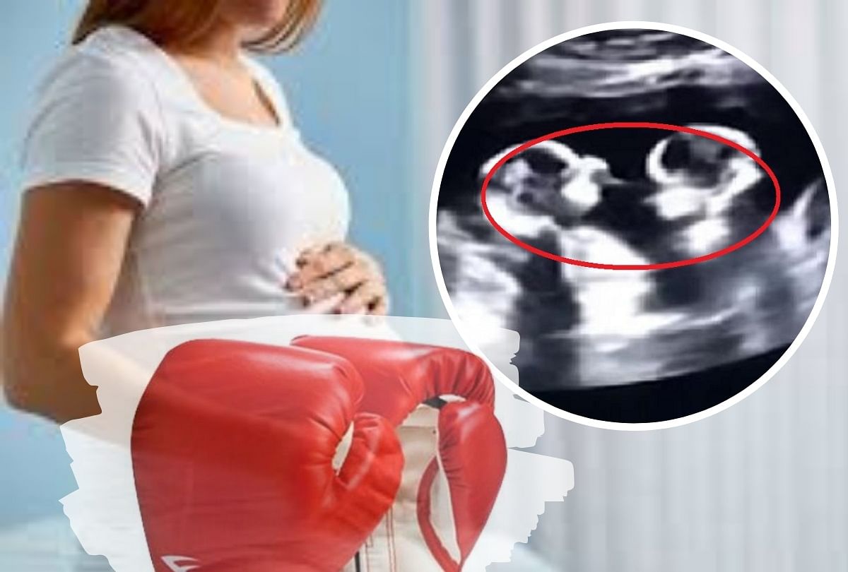 Twins Spotted Fighting Inside Mother Womb During Ultrasound Video Goes Viral Amar Ujala Hindi 6316