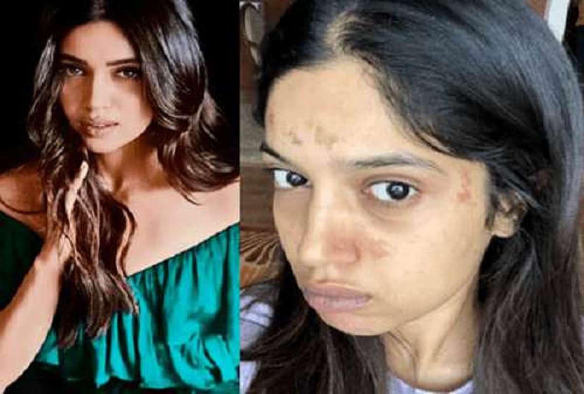 bhumi pednekar face fire during saand ki aankh shooting