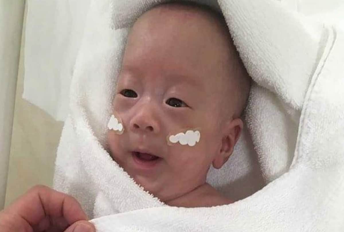 worlds smallest Japanese baby boy broke record for being born the size of an apple