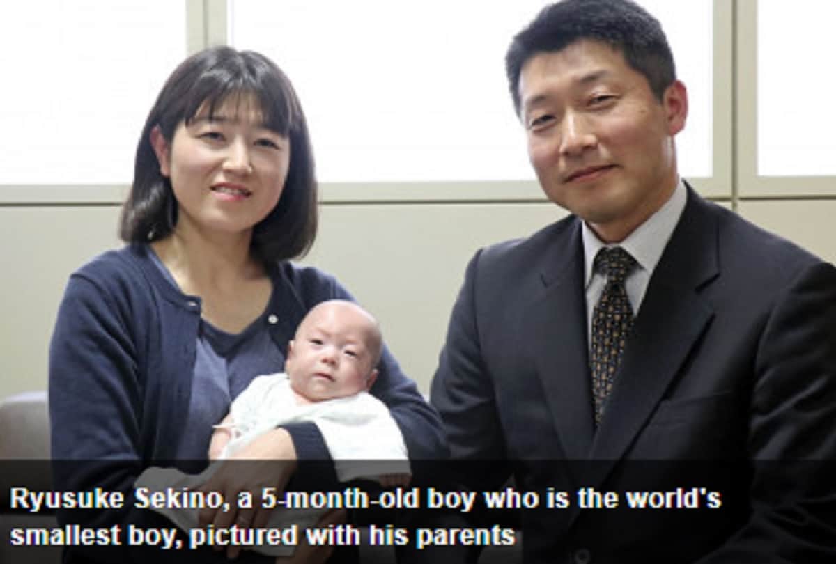 worlds smallest Japanese baby boy broke record for being born the size of an apple