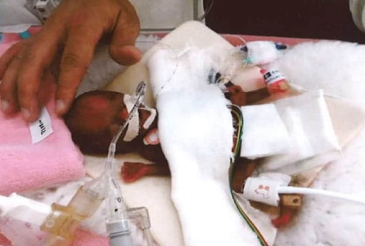 worlds smallest Japanese baby boy broke record for being born the size of an apple