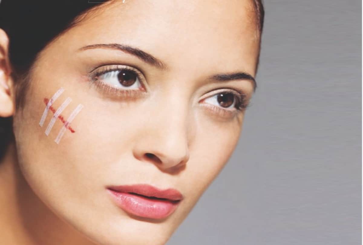 story of women who not hide her scars on her body