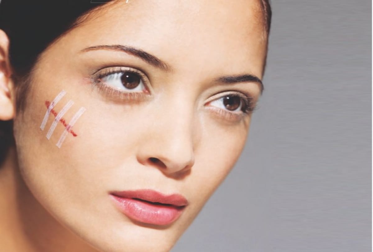 story of women who not hide her scars on her body