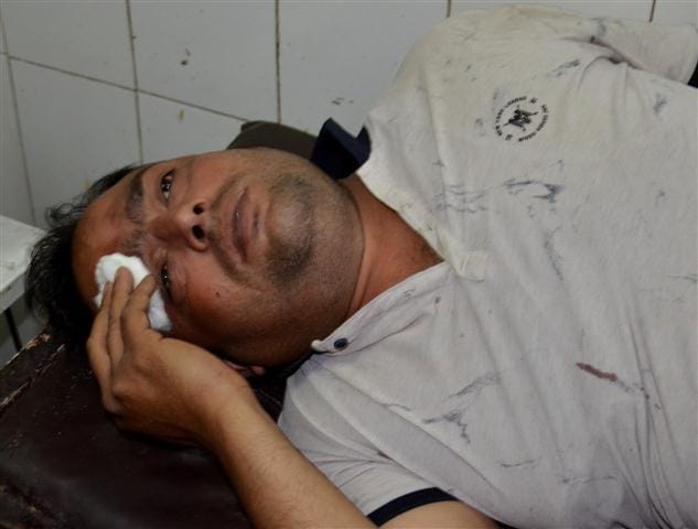 SP leader assaulted with BJP leader