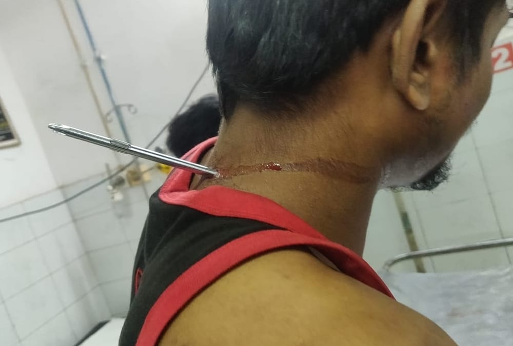doctors removed screwdriver from a man's neck in kgmu