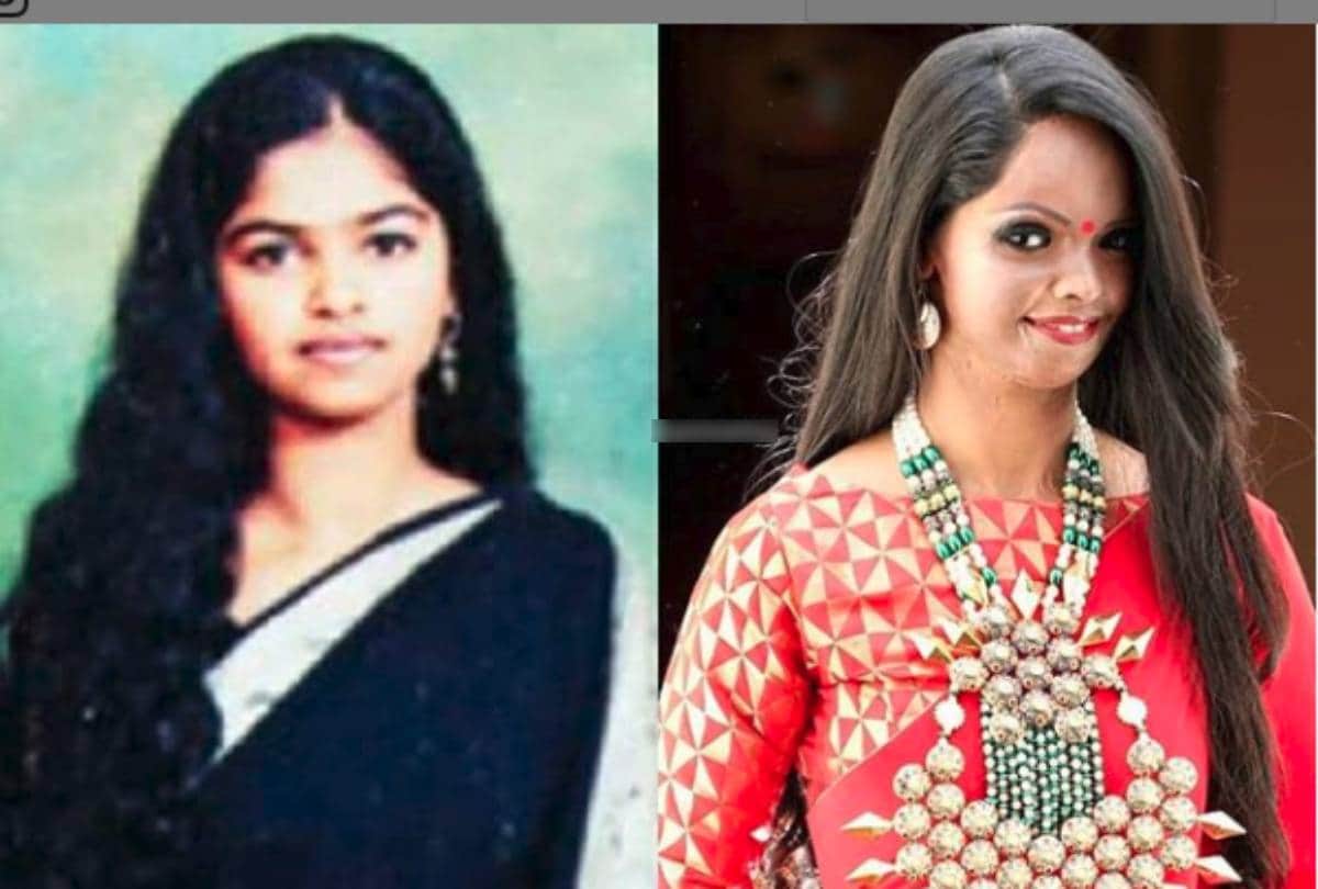 acid attack survivor laxmi agarwal share his story says nothing change in 14 years