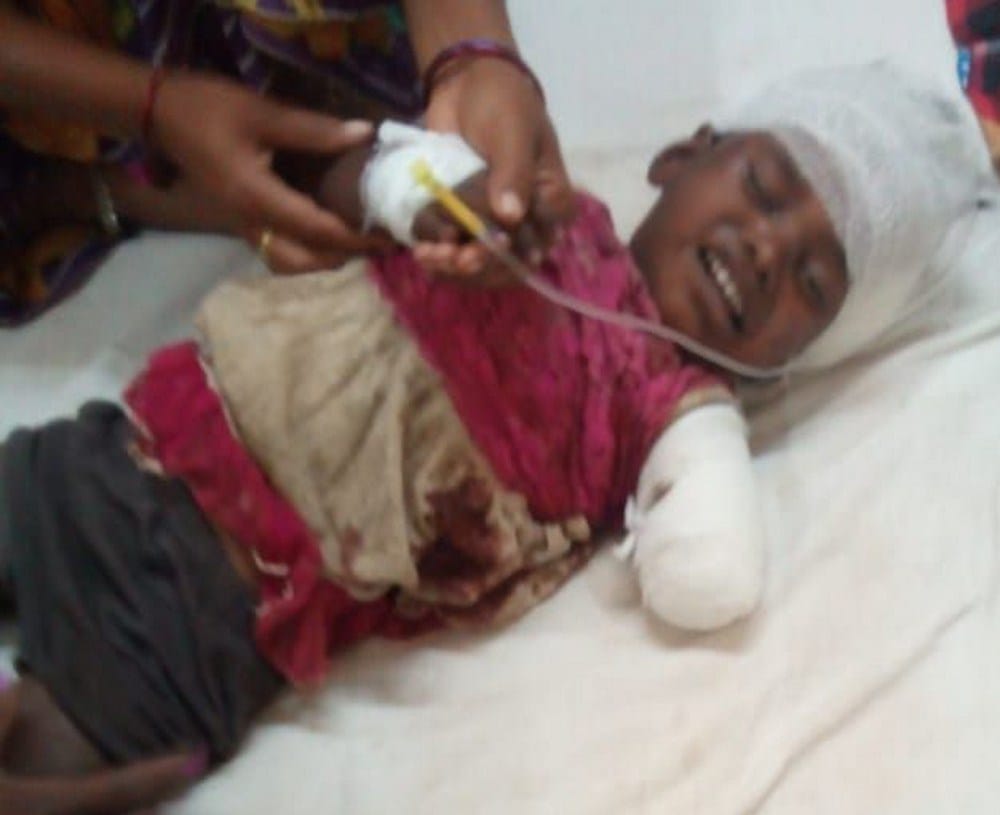 pigs attacked on a girl