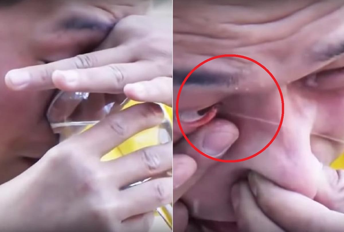 Chinese kung fu master inhaled water through nose Squirts It Out From His Eye Weird viral video
