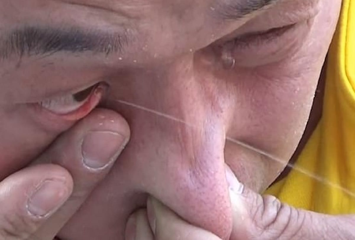 Chinese kung fu master inhaled water through nose Squirts It Out From His Eye Weird viral video