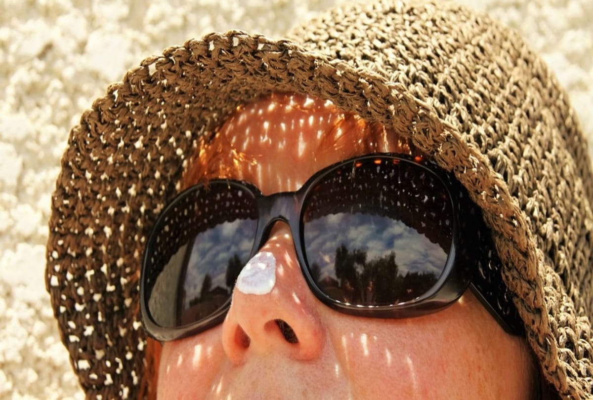 female above 30 age suffering from scleroderma skin disease with no treatment