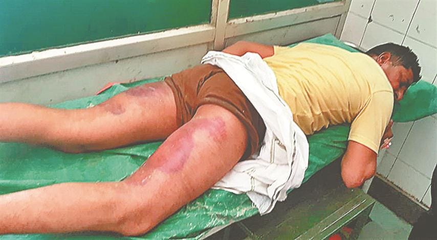 The victim was beaten, wounded by the shopkeeper by the excuse
