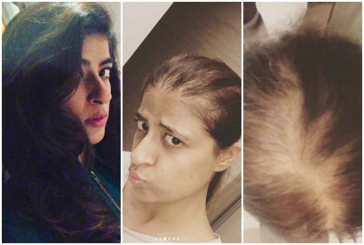 ayushmann khurrana wife tahira kashyap emotional post after cancer treatment