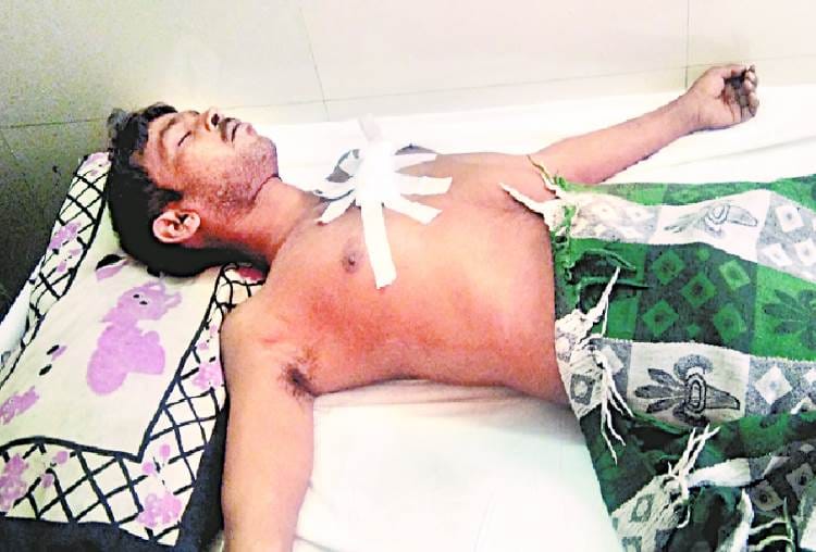 bull attacked on a man, injured in lucknow