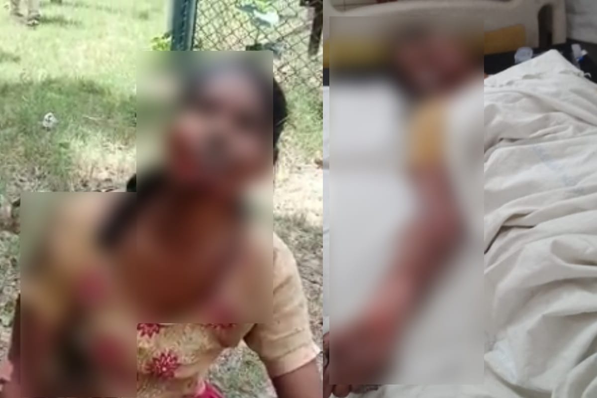 Meerut: woman caught by electric scuffle in district hospital