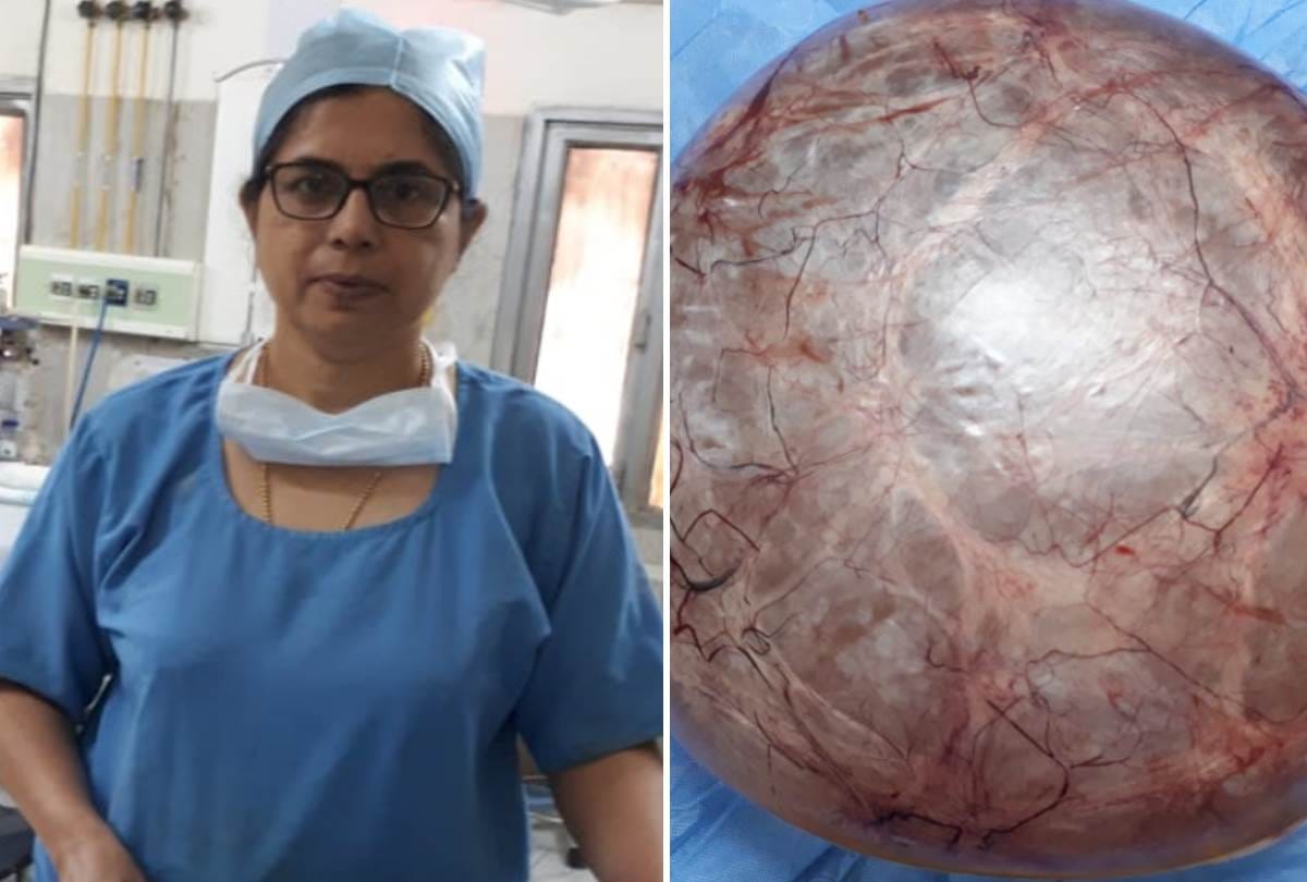 doctors removed 11.5 kg tumor from woman's stomach
