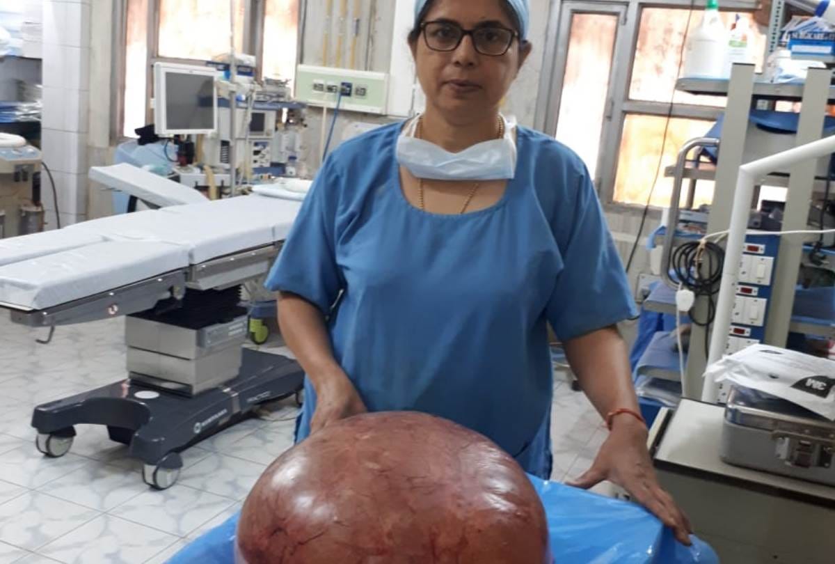 doctors removed 11.5 kg tumor from woman's stomach