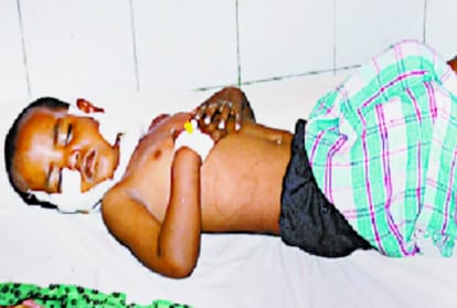 leopard attacked on a girl in bahraich