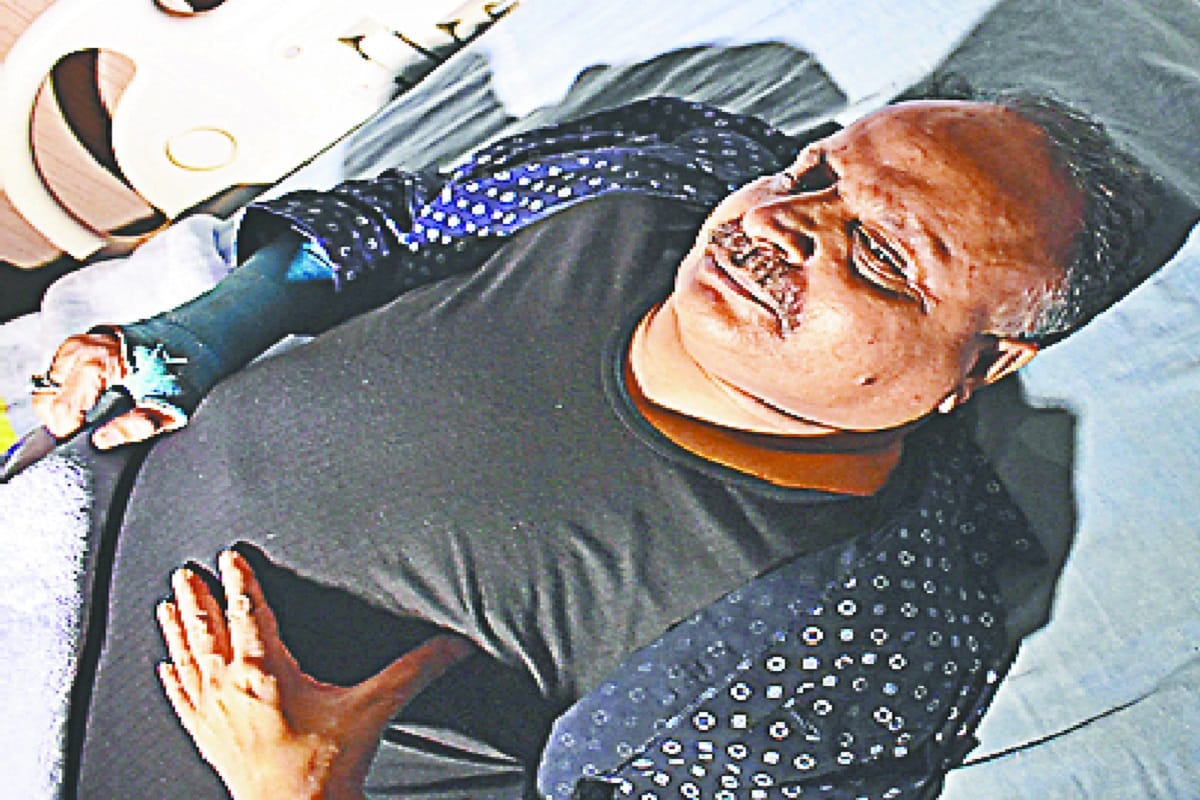 Hariom Anand jumping from second floor in Meerut at Uttar Pradesh