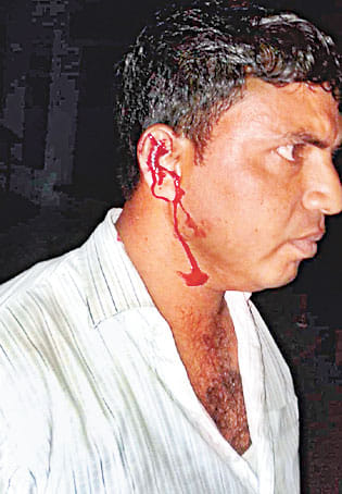 railway workers beaten