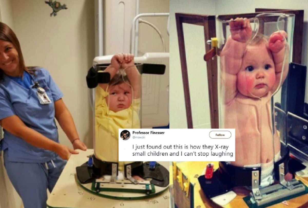 photos of small kids under pigg o stat x-ray machine is being viral and I can’t stop laughing