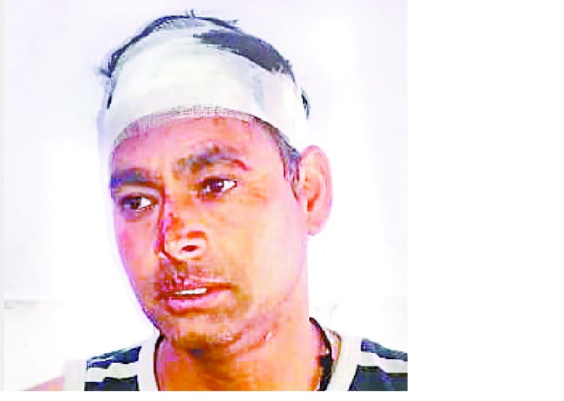 ghaayal hone par bhee diler deveedatt ne tendue ko bhaagane par kiya majaboor