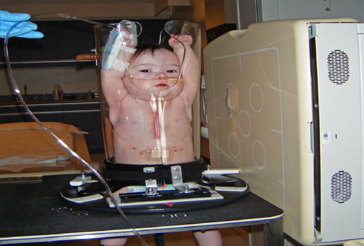 photos of small kids under pigg o stat x-ray machine is being viral and I can’t stop laughing
