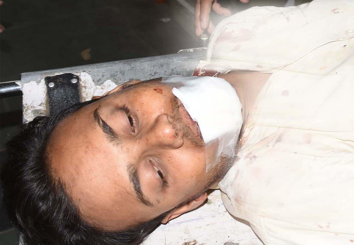 Boy dropped from thirty feet height from bridge
