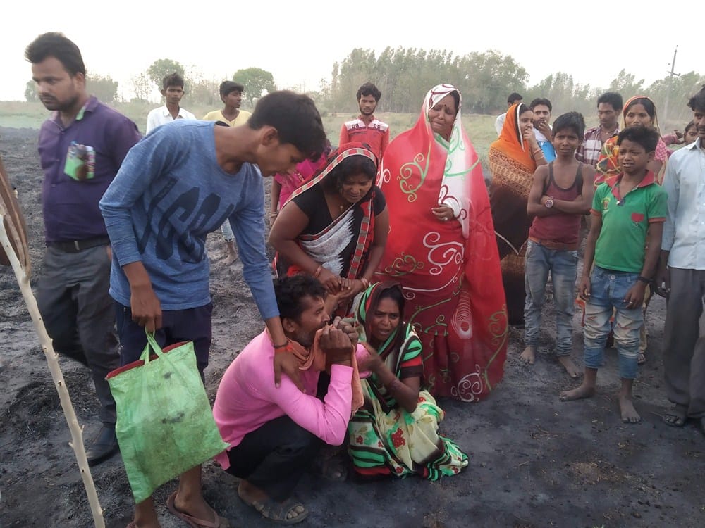 a girl burnt by hightension wire