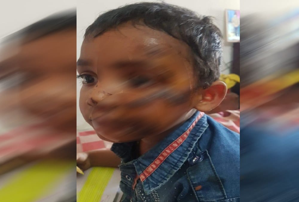 Lkg Student fall from running school bus and injured badly in dehradun 