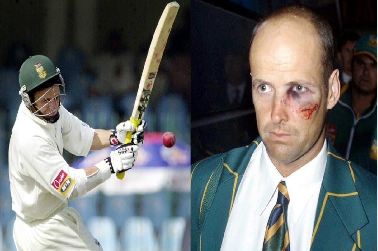 5 cricketets who fight like a warriors after brutal injury on ground