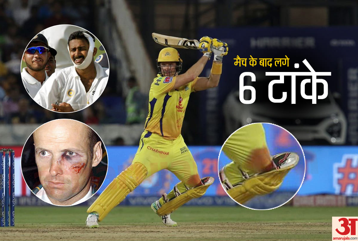 5 cricketets who fight like a warriors after brutal injury on ground