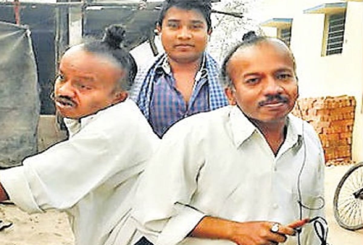 Two brothers, Ram and Shyam are connected each other with the body from last 40 years