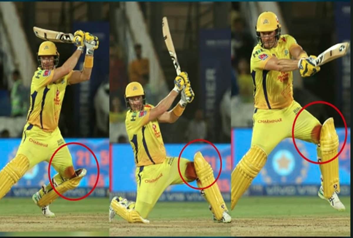 Shane Watson new video going viral on social media with injured bleeding leg after final of IPL 2019
