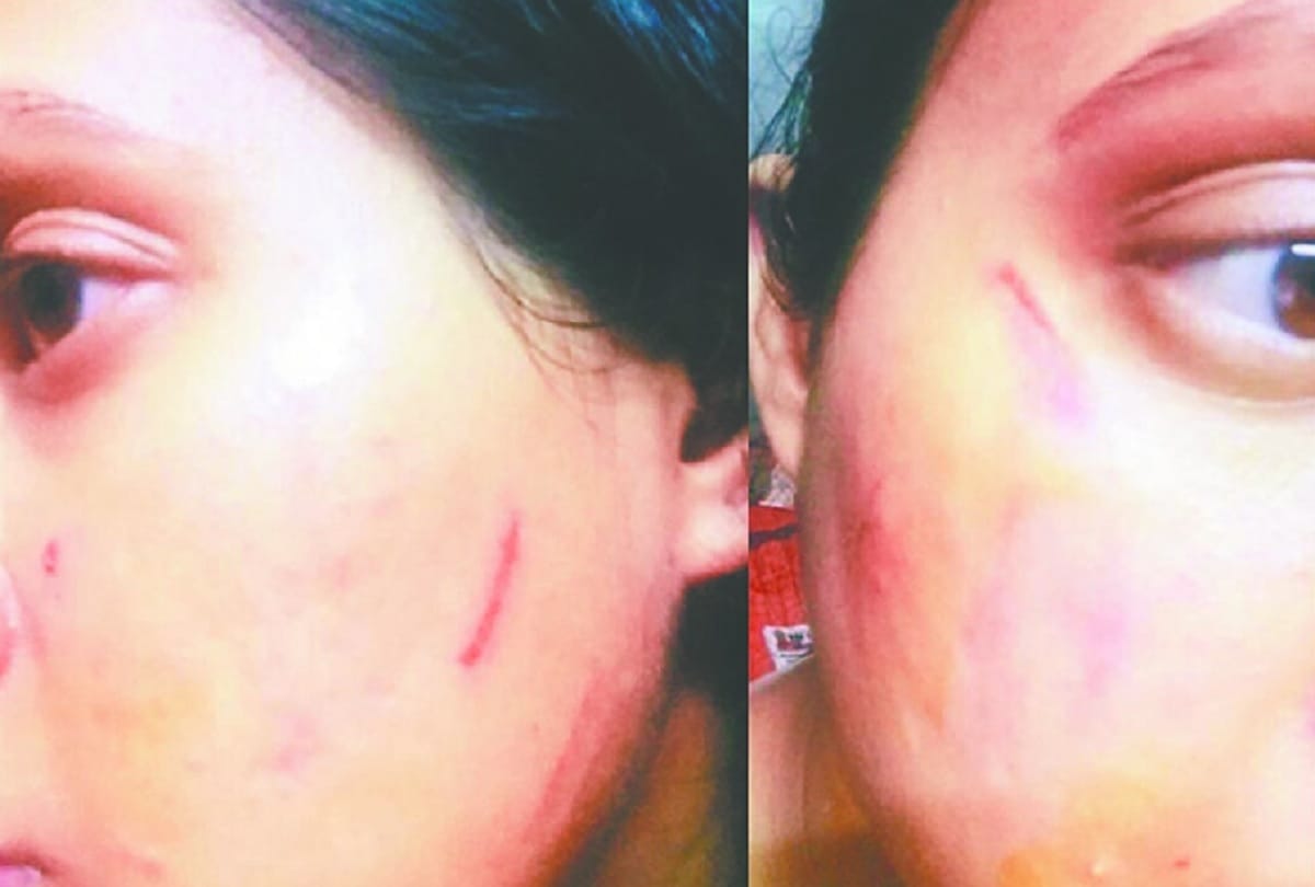 woman beaten over walking with pet in society
