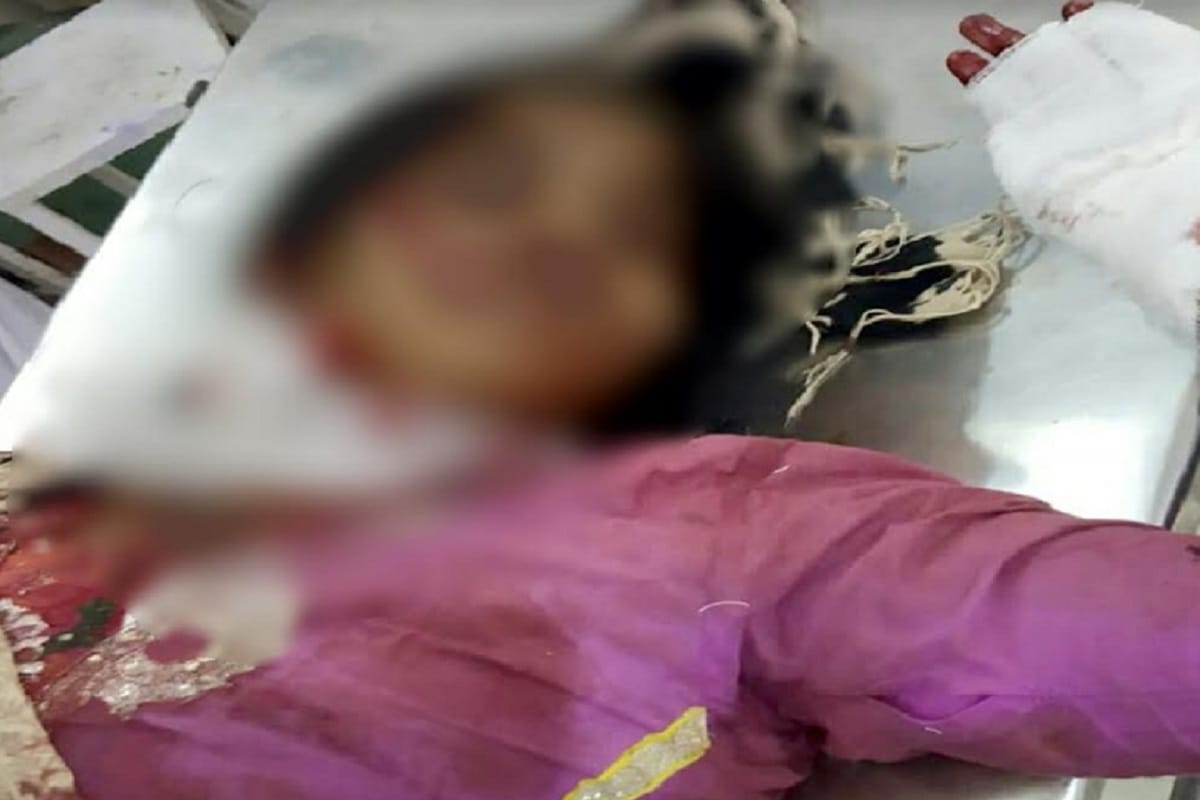Lover Ankle attacked from knife his law in daughter in Bijnor and girl injured