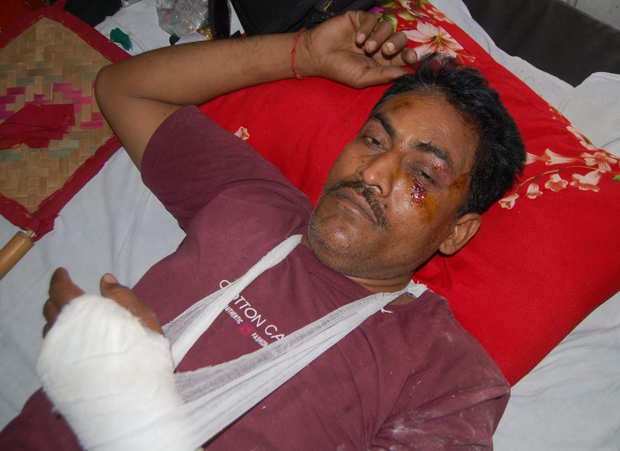तेज आवाज हुआ फिर आंखों के सामने छा गया अंधेरा