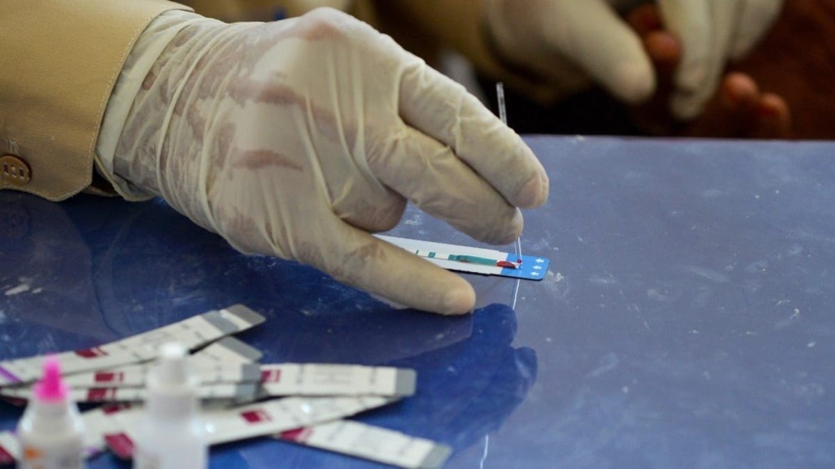 Teenager sample taken again to know level of corona infection