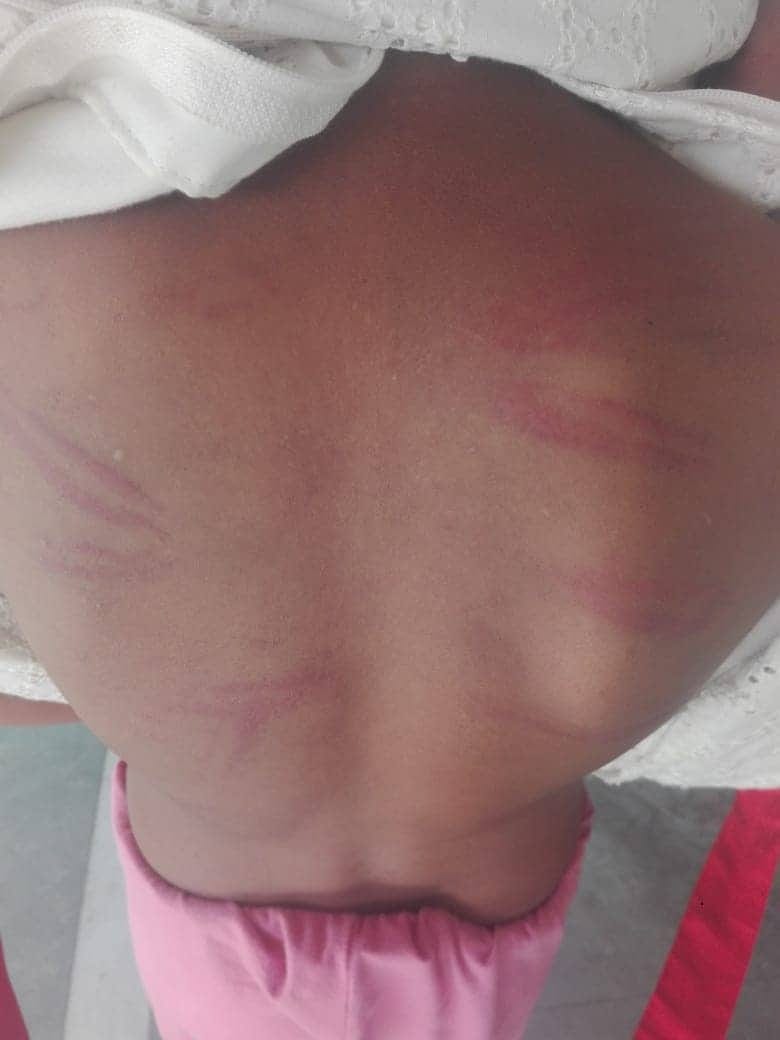 teachers ruthlessly beaten schoolgirl in tanakpur