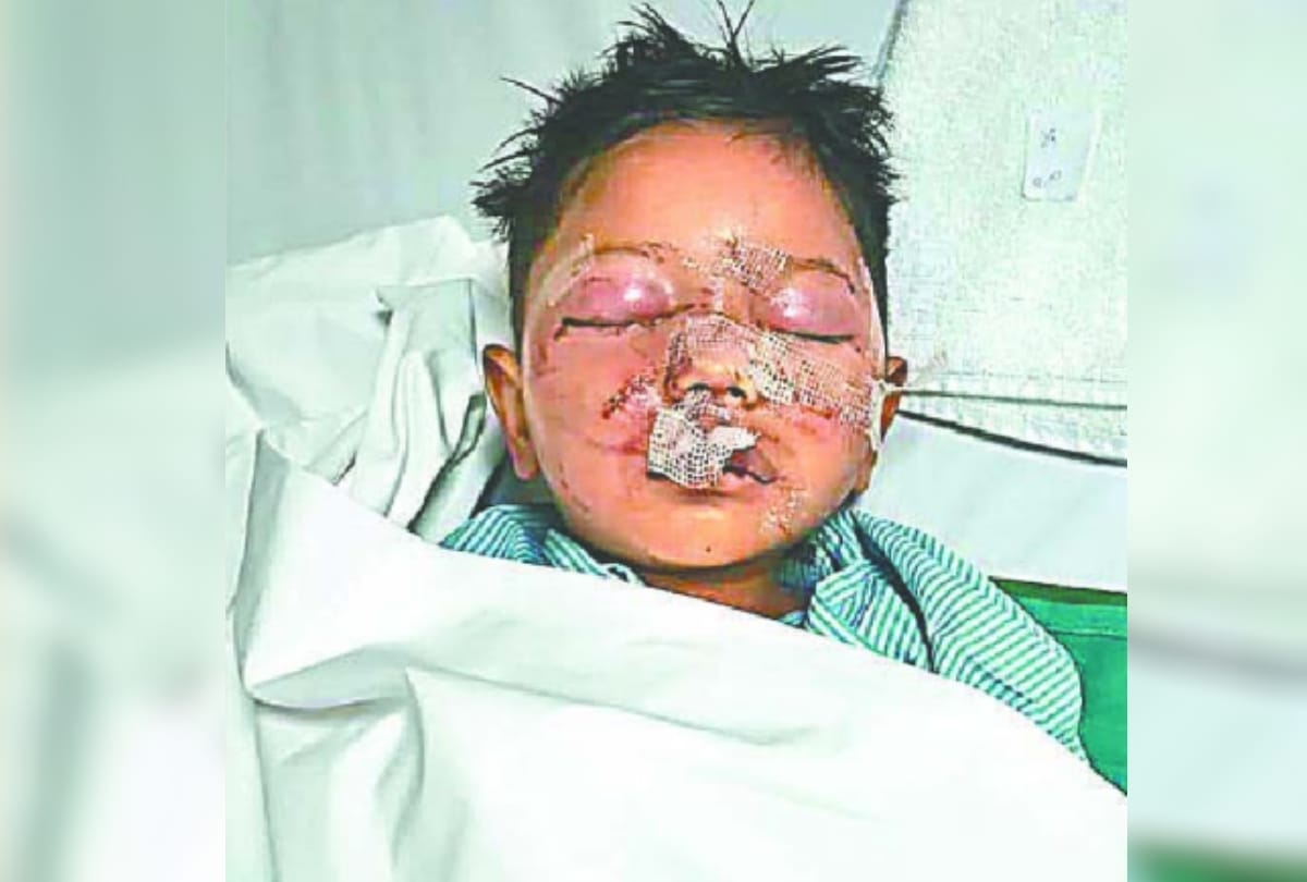 Four year old child found in nursery in injured condition at sahibabad
