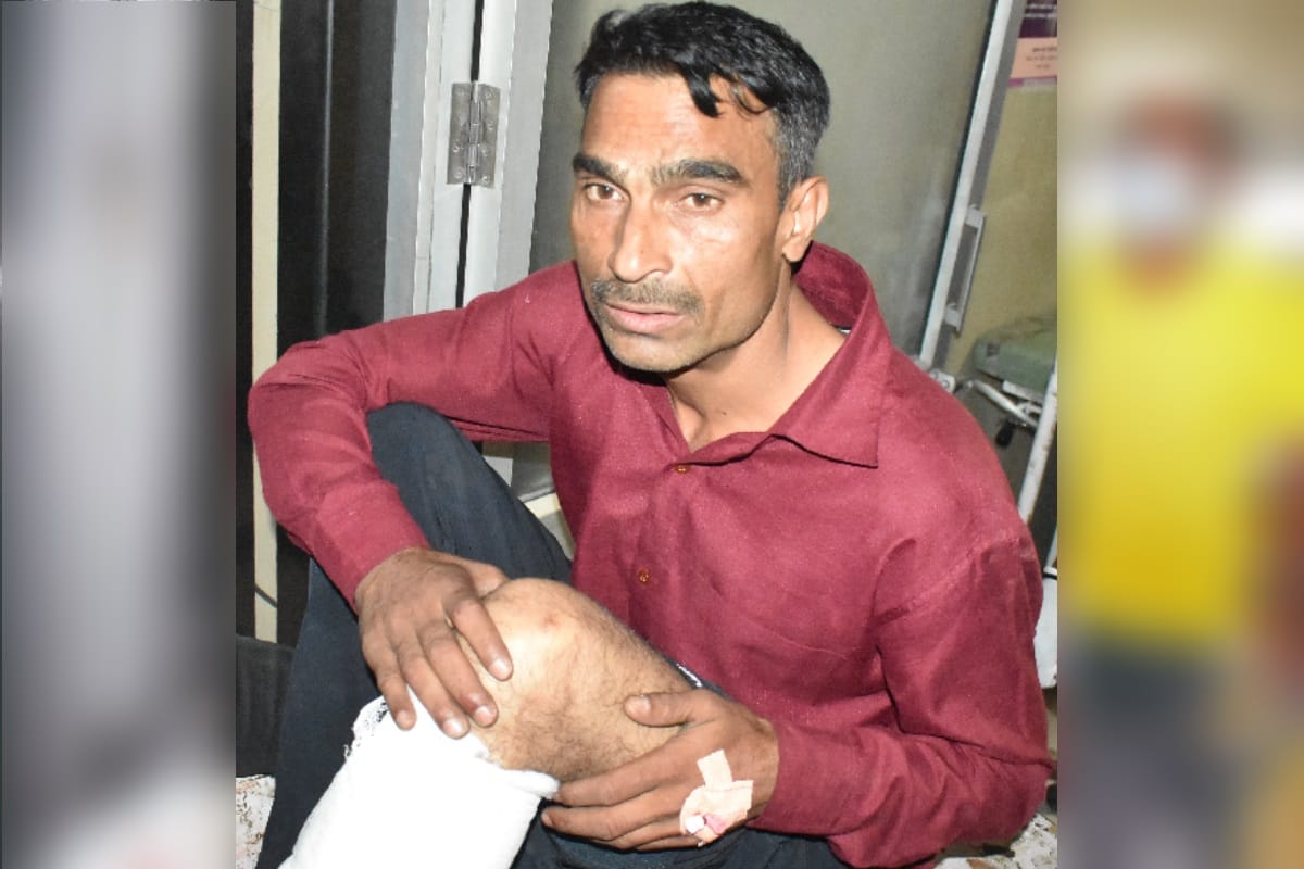 police encounter: raised questions after the injured badmash  working himself in hospital