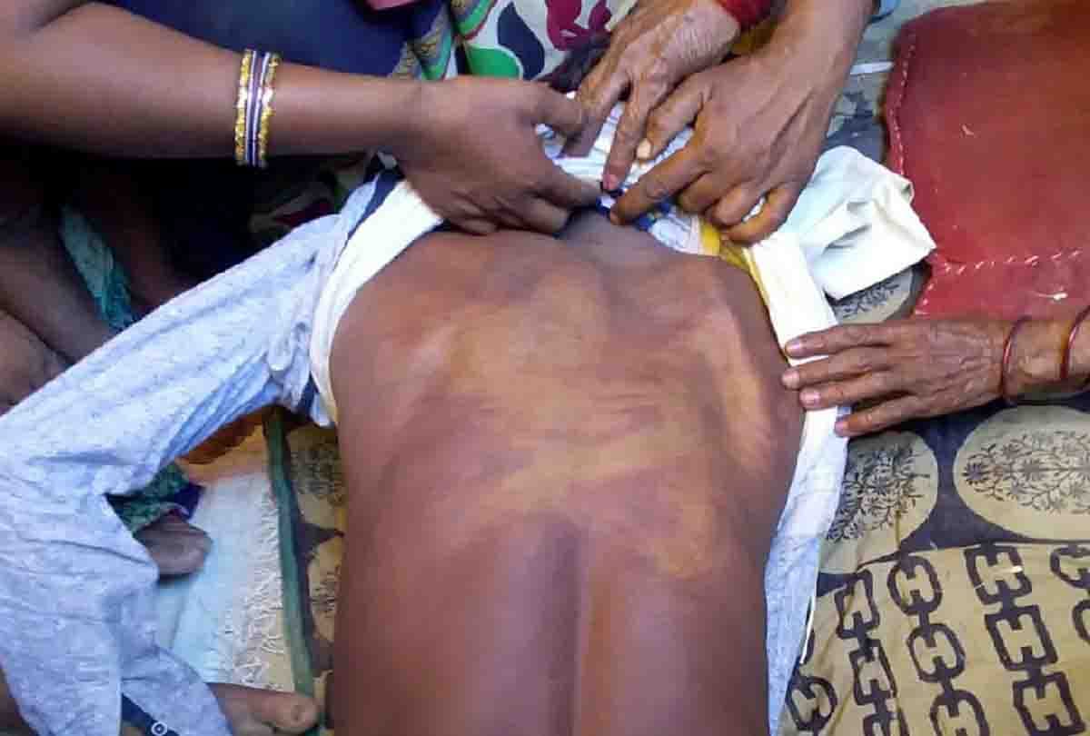up police brutally beating man and he died
