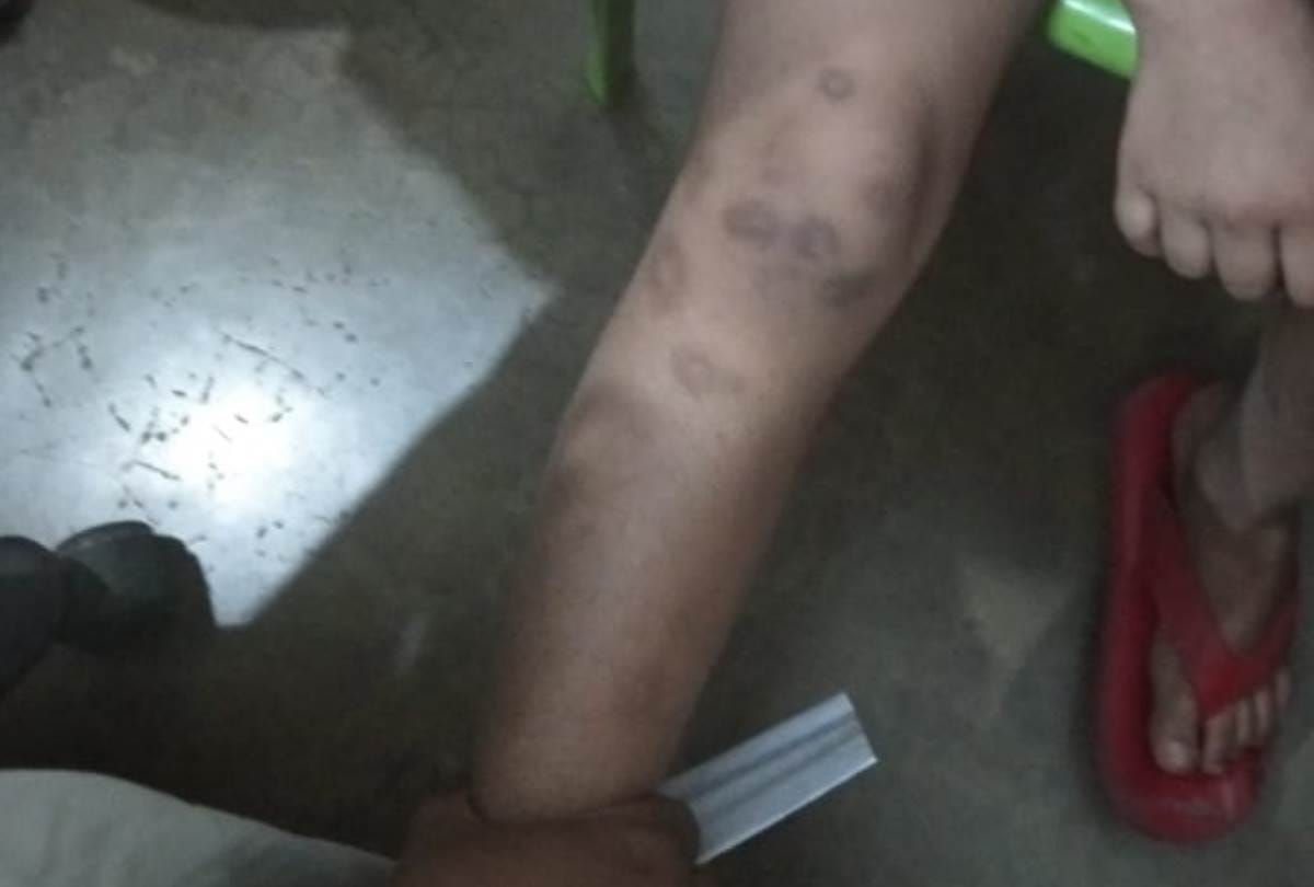 seven year old girl tortured by lady in lucknow