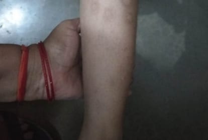 seven year old girl tortured by lady in lucknow